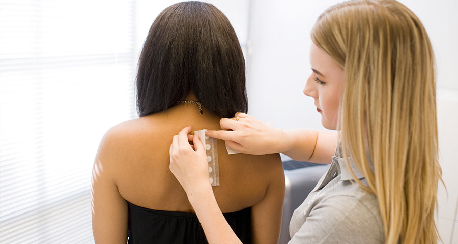 Allergietest am Rücken in der Hautarztpraxis in München