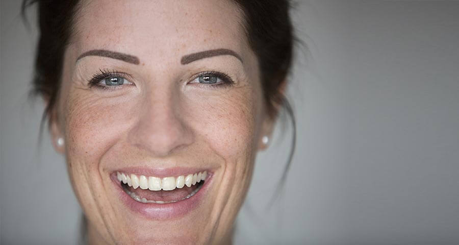 Behandlung von Rosacea