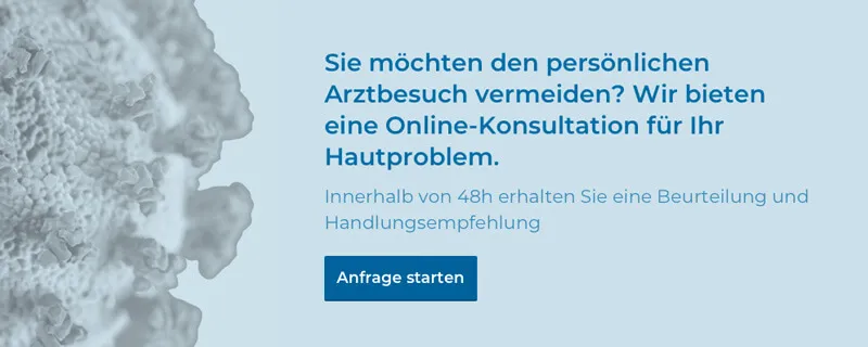 Online-Konsultation Dermazent