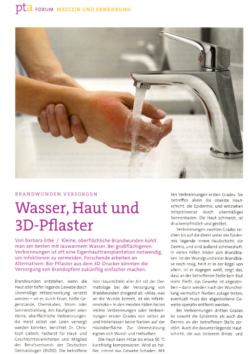 Brandwunden